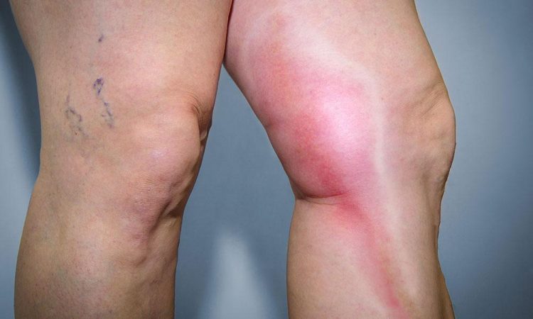 Know more about Vein Specialist